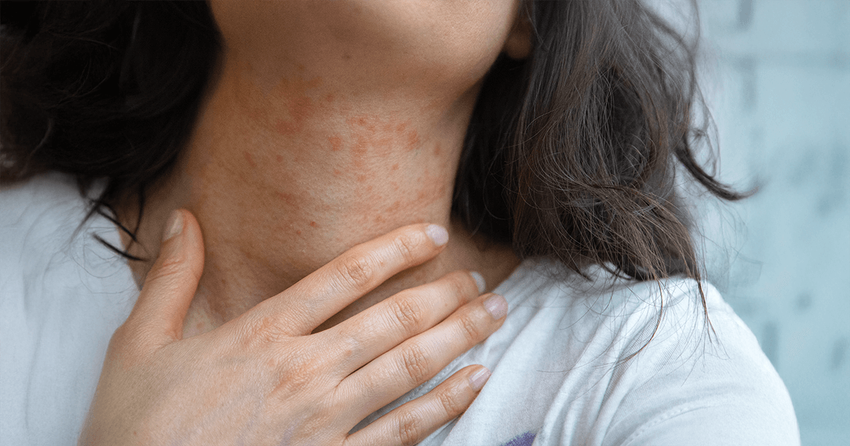 Why Is A Skin Patch Test Important?